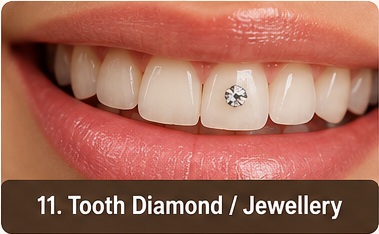 Tooth Jewellery treatment image